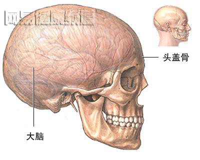 颅骨切开术图片