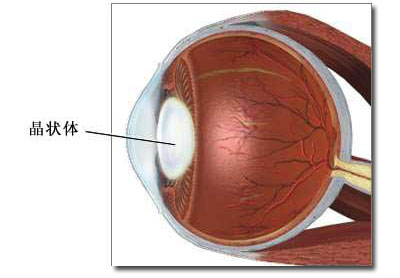 白内障手术图片